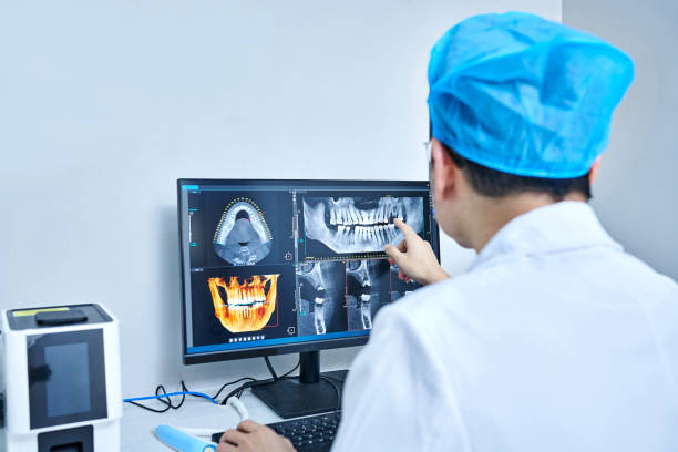 Best Emergency Root Canal Treatment in Millers Creek, NC